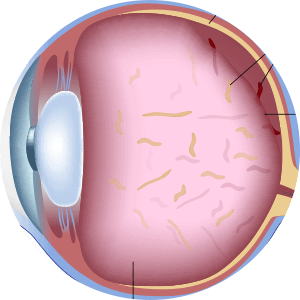 Diagram of the Eye